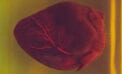 Heart Stents more effective for patients with stable high-risk heart disease